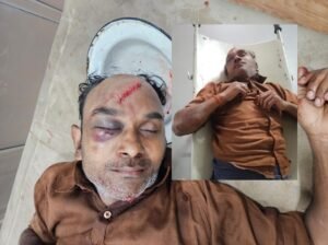तेज रफ्तार अज्ञात बाइक ने अधेड को मारी टक्कर, गंभीर घायल